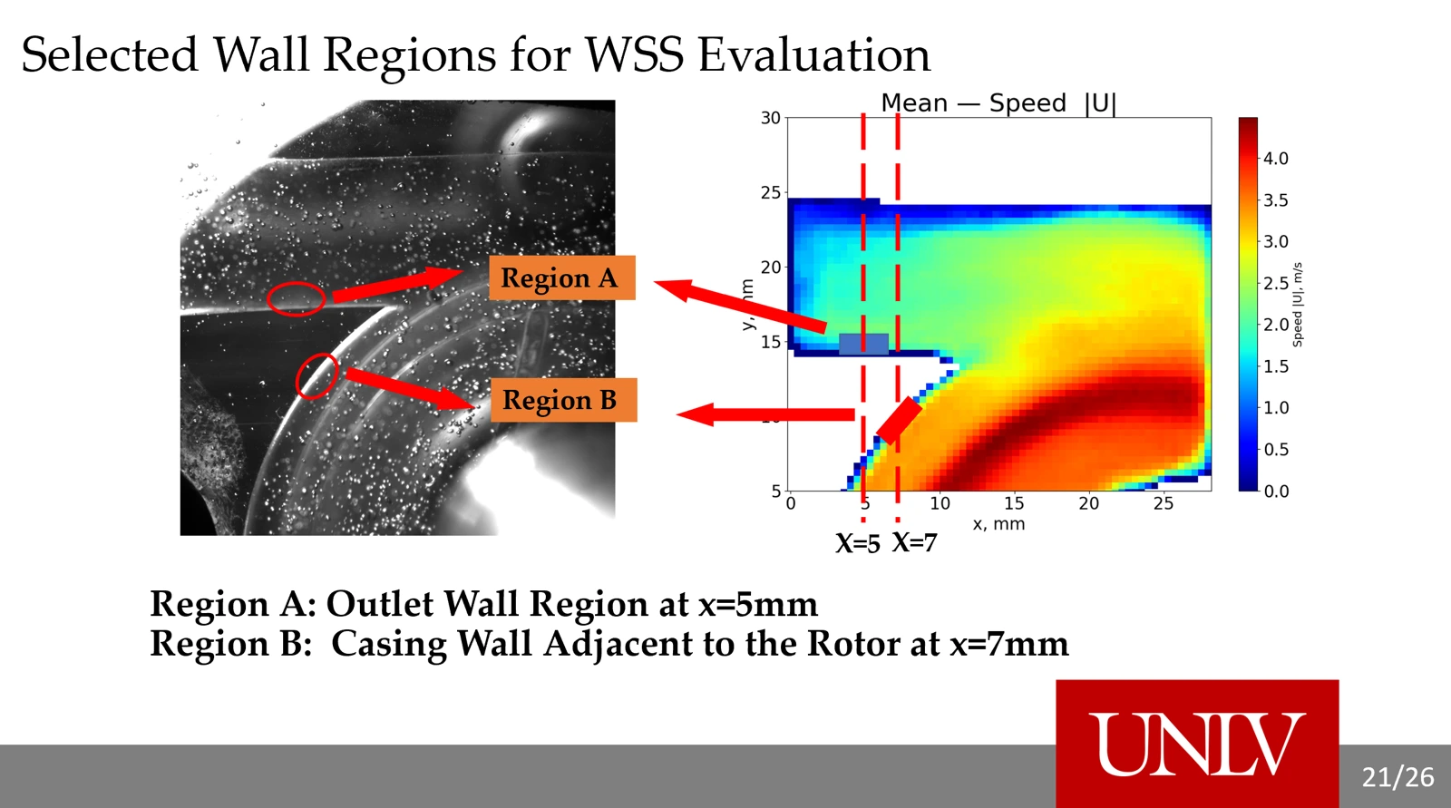 Siquan Huo’s presentation: selected wall regions for wall shear stress evaluation